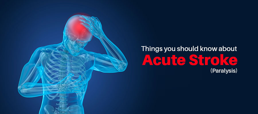 Things You Should Know About Acute Stroke (Paralysis)